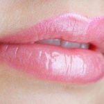 powiększanie ust kwasem hialuronowym, jak powiększyć usta, restylane