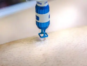 laser frakcyjny, laser frakcyjny poznań, laser frakcyjny co2, lasery frakcyjne