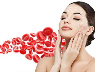 osocze bogatopłytkowe, wampirzy lifting, osocze bogatopłytkowe Arhtrex ACP, osocze bogatopłytkowe Poznań