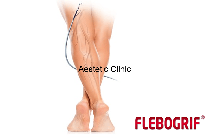 flebogrif