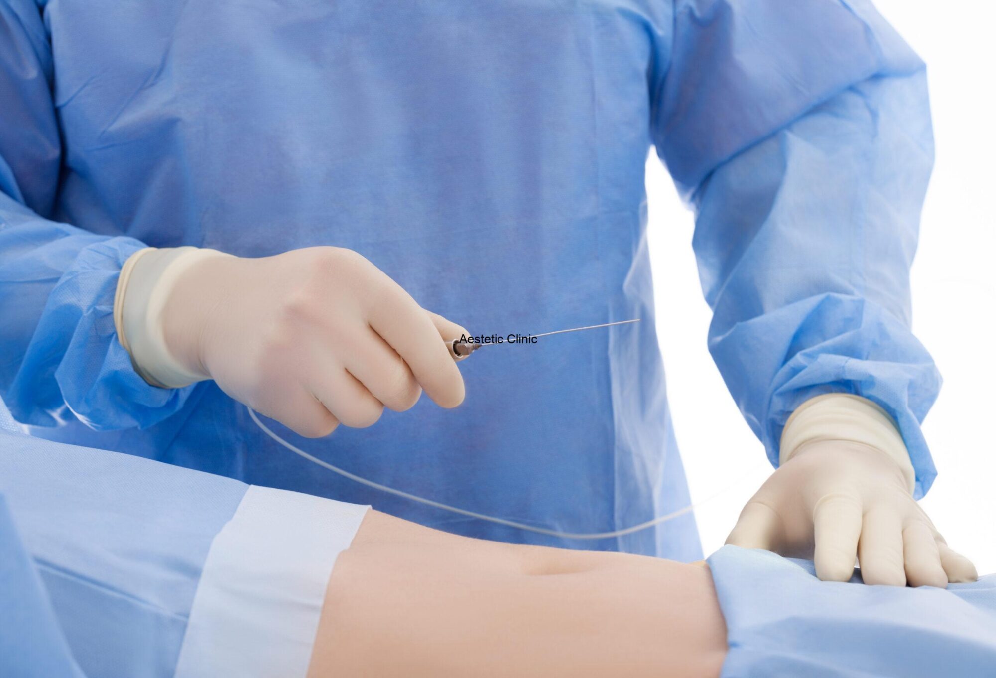 lipoliza laserowa, lipoliza laserowa Poznań