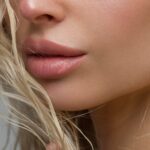 LipLase – laserowe powiększanie ust