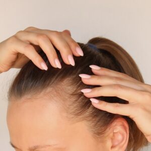 Jak zatrzymać łysienie u kobiet?