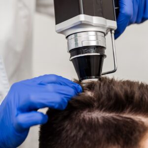 badanie trychoskopowe