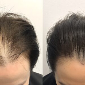 Sposoby na wypadające włosy