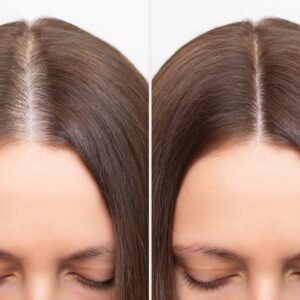 trwałość przeszczepionych włosów