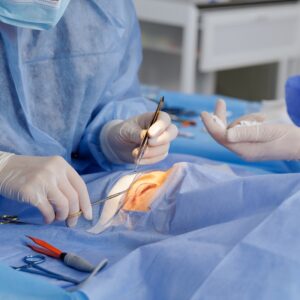 Czy plastyka powiek jest bezpieczna?