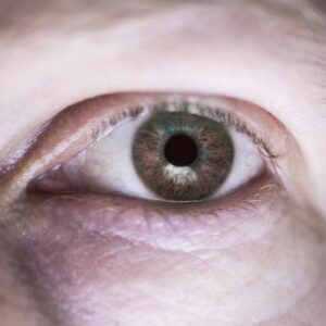 Przeciwwskazania do blefaroplastyki